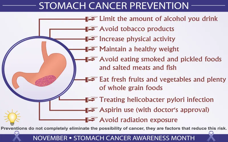 καρκίνος στομάχου-πρόληψη