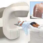 Καρκίνος Θυρεοειδούς και Εξωτερική Ακτινοθεραπεία