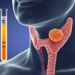 Πως να Mειώσω το Ασβέστιο;