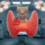 Χειρουργείο για Καρκίνο Θυρεοειδούς: Πότε γίνεται θυρεοειδεκτομή, πώς γίνεται η επέμβαση και ποια είναι η ανάρρωση;